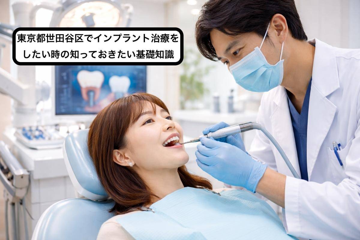 東京都世田谷区でインプラント治療をしたい時の知っておきたい基礎知識